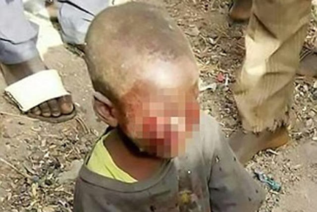 🚨Madrasta arranca olhos de enteado de 4 anos após ele urinar na cama