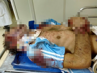 Homem morre atropelado na Via Parafuso em Camaçari