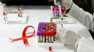 Menos da metade dos infectados por HIV e tuberculose tomam antirretroviral