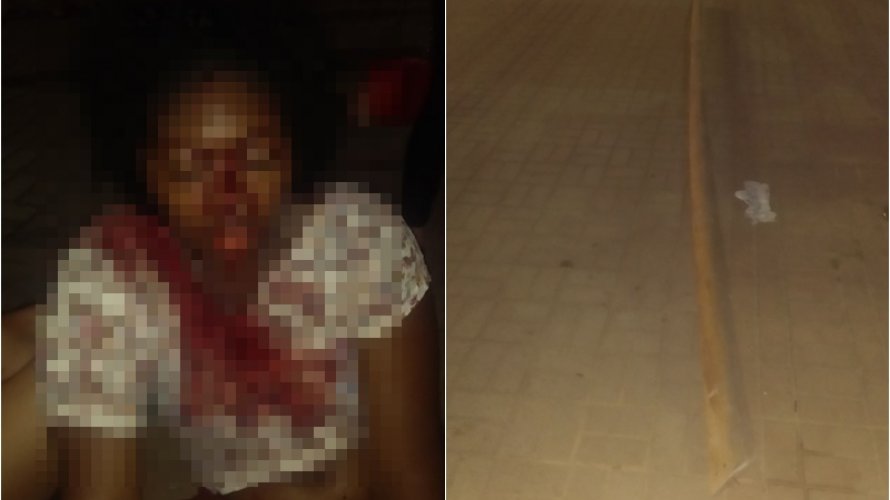 Jovem fica gravemente ferida após ser atingida por madeira de estrutura de praça do Imbuí