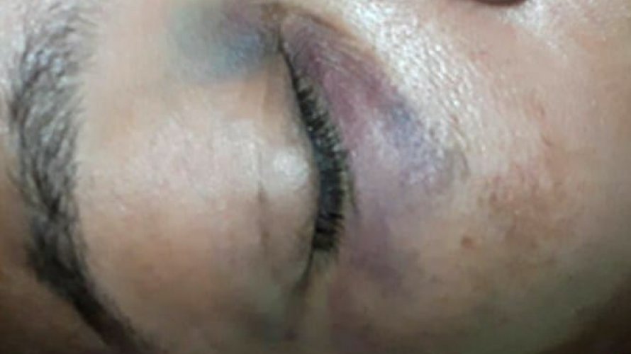 Cobradora de ônibus é agredida por baleiro após se negar a trocar R$ 5 na Estação da Lapa