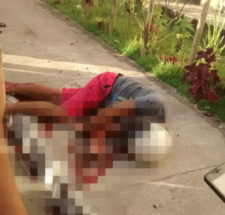 Violência: homem é baleado no Algarobas em Camaçari