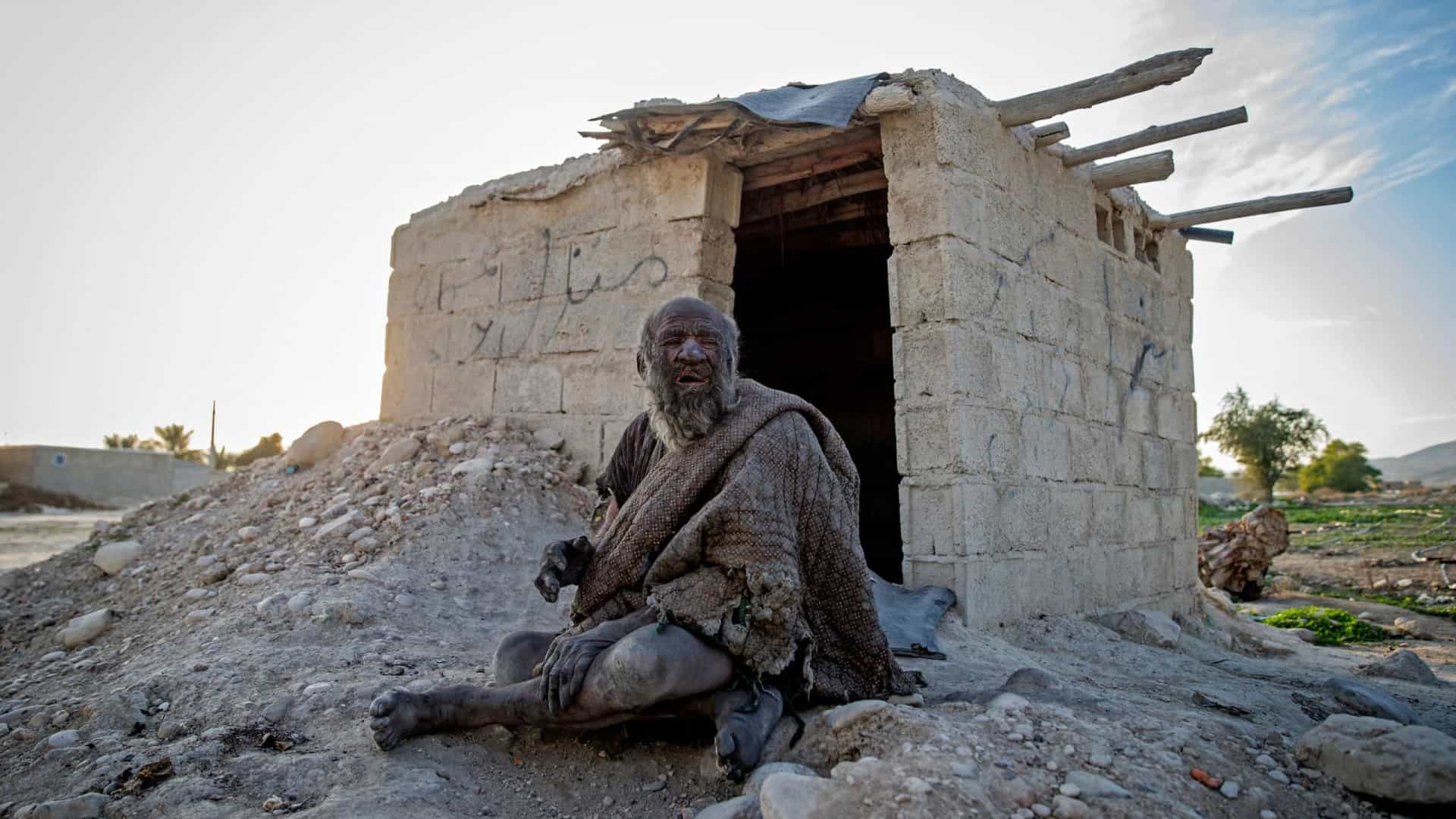 Homem ‘mais sujo do mundo’ morre meses após tomar primeiro banho